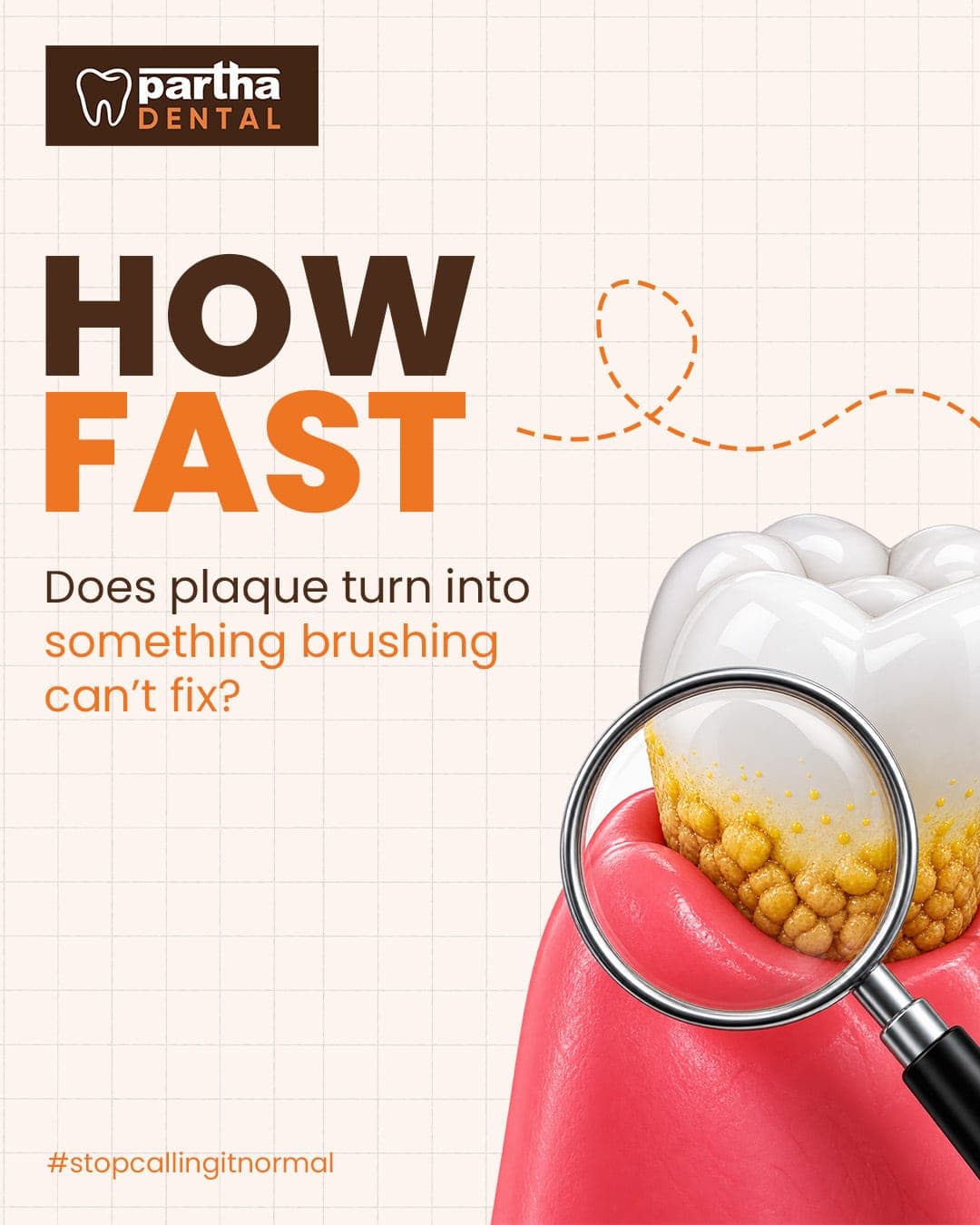 How fast does plaque turn into something brushing can't fix?
